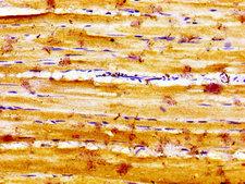 SLC16A12 / MCT12 Antibody - Immunohistochemistry image of paraffin-embedded human skeletal muscle tissue at a dilution of 1:100