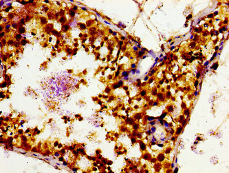 SLC16A12 / MCT12 Antibody - Immunohistochemistry image of paraffin-embedded human testis tissue at a dilution of 1:100
