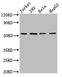 SLC16A12 / MCT12 Antibody - Positive Western Blot detected in Jurkat whole cell lysate, 293 whole cell lysate, Hela whole cell lysate, HepG2 whole cell lysate. All lanes: SLC16A12 antibody at 3 µg/ml Secondary Goat polyclonal to rabbit IgG at 1/50000 dilution. Predicted band size: 54 KDa. Observed band size: 54 KDa