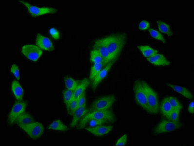 SLC16A12 / MCT12 Antibody - Immunofluorescence staining of HepG2 cells with SLC16A12 Antibody at 1:200, counter-stained with DAPI. The cells were fixed in 4% formaldehyde, permeabilized using 0.2% Triton X-100 and blocked in 10% normal Goat Serum. The cells were then incubated with the antibody overnight at 4°C. The secondary antibody was Alexa Fluor 488-congugated AffiniPure Goat Anti-Rabbit IgG(H+L).