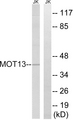 SLC16A13 Antibody - Western blot analysis of lysates from Jurkat cells, using MOT13 Antibody. The lane on the right is blocked with the synthesized peptide.