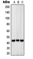 SLC16A13 Antibody - Western blot analysis of MCT13 expression in HeLa (A); mouse liver (B); rat liver (C) whole cell lysates.