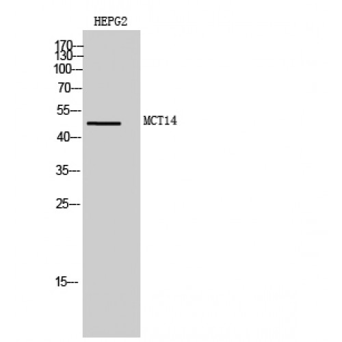 SLC16A14 / MCT14 Antibody - Western blot of MCT14 antibody