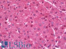 SLC16A14 / MCT14 Antibody - Human Liver: Formalin-Fixed, Paraffin-Embedded (FFPE)