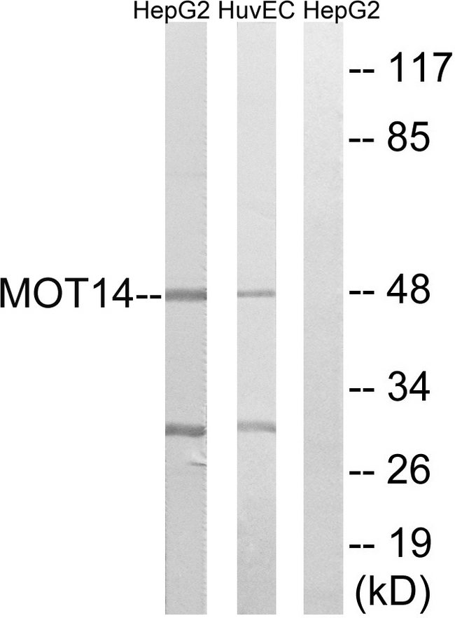 SLC16A14 / MCT14 Antibody - Western blot analysis of lysates from HUVEC and HepG2 cells, using MOT14 Antibody. The lane on the right is blocked with the synthesized peptide.