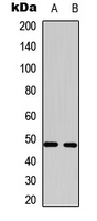 SLC16A14 / MCT14 Antibody - Western blot analysis of MCT14 expression in HepG2 (A); HeLa (B) whole cell lysates.