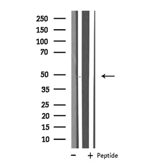 SLC16A14 / MCT14 Antibody - Western blot analysis of extracts of HepG2 cells using MOT14 antibody.