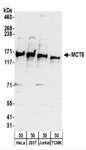 SLC16A2 / MCT8 Antibody - Detection of Human and Mouse MCT8 by Western Blot. Samples: Whole cell lysate (50 ug) from HeLa, 293T, Jurkat, and mouse TCMK-1 cells. Antibodies: Affinity purified rabbit anti-MCT8 antibody used for WB at 0.1 ug/ml. Detection: Chemiluminescence with an exposure time of 30 seconds.