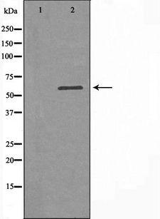SLC16A2 / MCT8 Antibody - Western blot analysis of extracts of K562 cells using SLC16A2 antibody. The lane on the left is treated with the antigen-specific peptide.