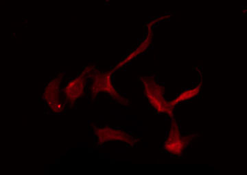SLC16A2 / MCT8 Antibody - Staining HeLa cells by IF/ICC. The samples were fixed with PFA and permeabilized in 0.1% Triton X-100, then blocked in 10% serum for 45 min at 25°C. The primary antibody was diluted at 1:200 and incubated with the sample for 1 hour at 37°C. An Alexa Fluor 594 conjugated goat anti-rabbit IgG (H+L) Ab, diluted at 1/600, was used as the secondary antibody.