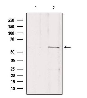SLC16A2 / MCT8 Antibody - Western blot analysis of extracts of mouse brain tissue using SLC16A2 antibody. Lane 1 was treated with the blocking peptide.