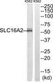 SLC16A2 / MCT8 Antibody - Western blot analysis of extracts from K562 cells, using SLC16A2 antibody.