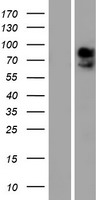SLC16A2 / MCT8 Protein - Western validation with an anti-DDK antibody * L: Control HEK293 lysate R: Over-expression lysate