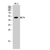 SLC16A3 Antibody - Western blot of MCT4 antibody