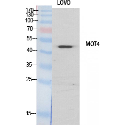 SLC16A3 Antibody - Western blot of MCT4 antibody