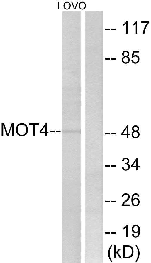 SLC16A3 Antibody - Western blot analysis of lysates from LOVO cells, using MOT4 Antibody. The lane on the right is blocked with the synthesized peptide.