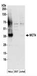 SLC16A3 Antibody - Detection of Human MCT4 by Western Blot. Samples: Whole cell lysate (50 ug) prepared using NETN buffer from HeLa, 293T, and Jurkat cells. Antibodies: Affinity purified rabbit anti-MCT4 antibody used for WB at 0.1 ug/ml. Detection: Chemiluminescence with an exposure time of 3 minutes.