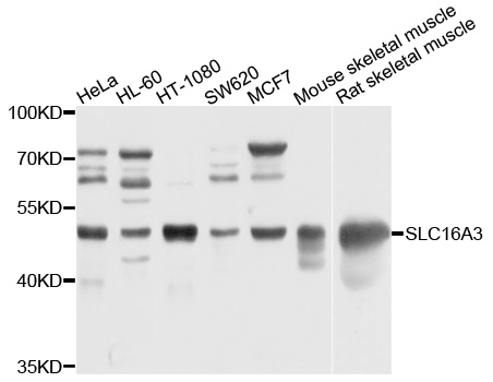 SLC16A3 Antibody - Western blot analysis of extracts of various cells.