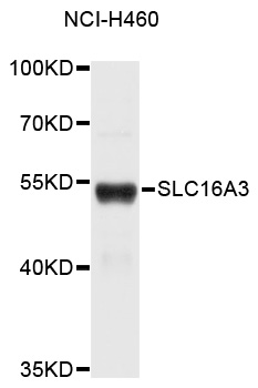SLC16A3 Antibody - Western blot analysis of extracts of NCI-H460 cells, using SLC16A3 antibody. The secondary antibody used was an HRP Goat Anti-Rabbit IgG (H+L) at 1:10000 dilution. Lysates were loaded 25ug per lane and 3% nonfat dry milk in TBST was used for blocking.