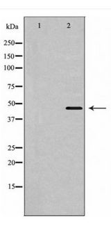SLC16A3 Antibody - Western blot of MOT4 expression in HeLa lysate