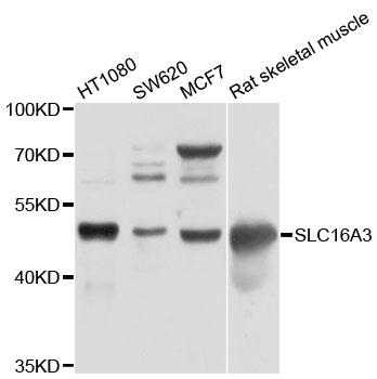 SLC16A3 Antibody - Western blot analysis of extracts of various cell lines, using SLC16A3 antibody at 1:1000 dilution. The secondary antibody used was an HRP Goat Anti-Rabbit IgG (H+L) at 1:10000 dilution. Lysates were loaded 25ug per lane and 3% nonfat dry milk in TBST was used for blocking. An ECL Kit was used for detection and the exposure time was 15s.