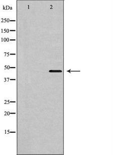 SLC16A3 Antibody - Western blot analysis of MOT4 expression in HeLa lysate. The lane on the left is treated with the antigen-specific peptide.