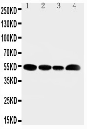 SLC16A4 Antibody - WB of SLC16A4 / MCT4 antibody. Lane 1: Rat Testis Tissue Lysate. Lane 2: JURKAT Cell Lysate. Lane 3: HELA Cell Lysate. Lane 4: MCF-7 Cell Lysate.