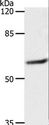 SLC16A4 Antibody - Western blot analysis of 231 cell, using SLC16A4 Polyclonal Antibody at dilution of 1:1200.