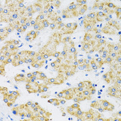 SLC16A4 Antibody - Immunohistochemistry of paraffin-embedded human liver using SLC16A4 antibody at dilution of 1:100 (40x lens).
