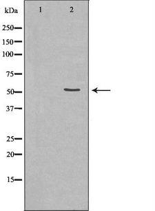 SLC16A4 Antibody - Western blot analysis of extracts of mouse muscle tissue lysate using SLC16A4 antibody. The lane on the left is treated with the antigen-specific peptide.