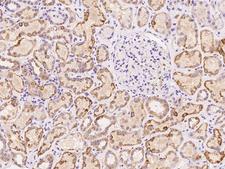 SLC16A4 Antibody - Immunochemical staining of human SLC16A4 in human kidney with rabbit polyclonal antibody at 1:100 dilution, formalin-fixed paraffin embedded sections.