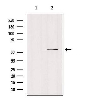 SLC16A5 / MCT5 Antibody - Western blot analysis of extracts of mouse brain tissue using MOT6 antibody. Lane 1 was treated with the blocking peptide.