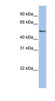 SLC16A6 / MCT6 Antibody - SLC16A6 antibody Western blot of HepG2 cell lysate. This image was taken for the unconjugated form of this product. Other forms have not been tested.