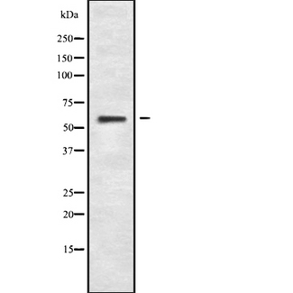 SLC16A6 / MCT6 Antibody - Western blot analysis of MOT7 using COS7 whole cells lysates