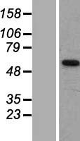 SLC16A6 / MCT6 Protein - Western validation with an anti-DDK antibody * L: Control HEK293 lysate R: Over-expression lysate