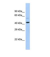 SLC16A7 / MCT2 Antibody - Western blot of Human Fetal Heart. SLC16A7 antibody dilution 1.0 ug/ml.  This image was taken for the unconjugated form of this product. Other forms have not been tested.