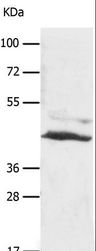 SLC16A7 / MCT2 Antibody - Western blot analysis of A549 cell, using SLC16A7 Polyclonal Antibody at dilution of 1:450.