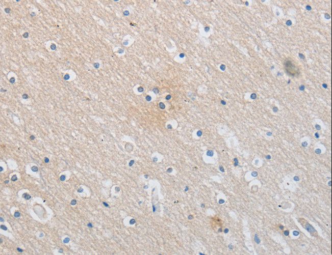 SLC16A7 / MCT2 Antibody - Immunohistochemistry of paraffin-embedded Human brain using SLC16A7 Polyclonal Antibody at dilution of 1:30.