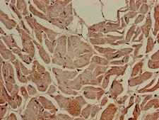 SLC16A7 / MCT2 Antibody - Immunohistochemistry of paraffin-embedded human heart tissue using SLC16A7 Antibody at dilution of 1:100