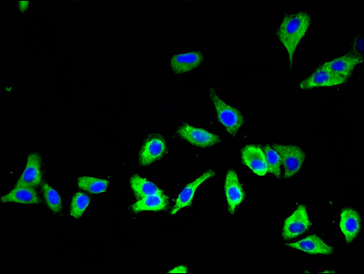 SLC16A7 / MCT2 Antibody - Immunofluorescent analysis of HepG2 cells using SLC16A7 Antibody at a dilution of 1:100 and Alexa Fluor 488-congugated AffiniPure Goat Anti-Rabbit IgG(H+L)