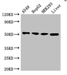 SLC16A7 / MCT2 Antibody - Western Blot Positive WB detected in: A549 whole cell lysate, HepG2 whole cell lysate, HEK293 whole cell lysate, Rat liver tissue All lanes: SLC16A7 antibody at 2.5µg/ml Secondary Goat polyclonal to rabbit IgG at 1/50000 dilution Predicted band size: 53 kDa Observed band size: 53 kDa
