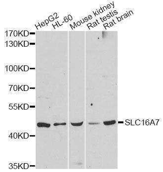 SLC16A7 / MCT2 Antibody - Western blot analysis of extracts of various cell lines, using SLC16A7 antibody at 1:3000 dilution. The secondary antibody used was an HRP Goat Anti-Rabbit IgG (H+L) at 1:10000 dilution. Lysates were loaded 25ug per lane and 3% nonfat dry milk in TBST was used for blocking. An ECL Kit was used for detection and the exposure time was 90s.