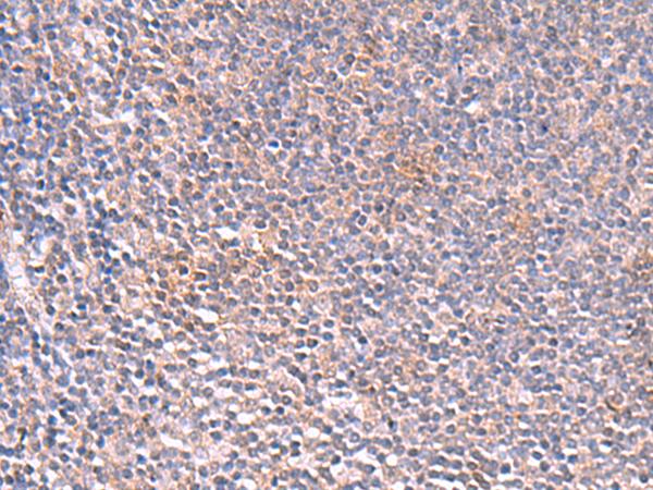 SLC16A7 / MCT2 Antibody - Immunohistochemistry of paraffin-embedded Human tonsil tissue  using SLC16A7 Polyclonal Antibody at dilution of 1:35(×200)