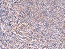 SLC16A7 / MCT2 Antibody - Immunohistochemistry of paraffin-embedded Human tonsil tissue  using SLC16A7 Polyclonal Antibody at dilution of 1:35(×200)