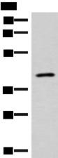 SLC16A7 / MCT2 Antibody - Western blot analysis of Human abdominal interstitial sarcoma tissue lysate  using SLC16A7 Polyclonal Antibody at dilution of 1:400