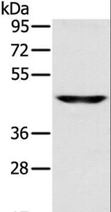 SLC16A8 Antibody - Western blot analysis of Human fetal brain tissue, using SLC16A8 Polyclonal Antibody at dilution of 1:200.