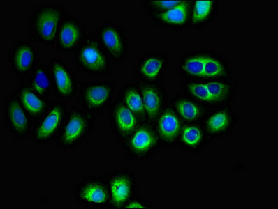 SLC16A8 Antibody - Immunofluorescent analysis of A549 cells diluted at 1:100 and Alexa Fluor 488-congugated AffiniPure Goat Anti-Rabbit IgG(H+L)