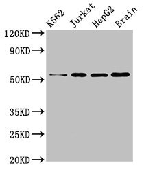 SLC16A8 Antibody - Western Blot Positive WB detected in:K562 whole cell lysate,Jurkat whole cell lysate,HepG2 whole cell lysate,Mouse brain tissue All Lanes:SLC16A8 antibody at 3µg/ml Secondary Goat polyclonal to rabbit IgG at 1/50000 dilution Predicted band size: 53 KDa Observed band size: 53 KDa
