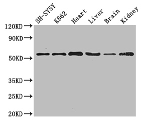 SLC16A9 Antibody - Positive WB detected in:SH-SY5Y whole cell lysate,K562 whole cell lysate,Mouse heart tissue,Mouse liver tissue,Mouse brain tissue,Mouse kidney tissue;All lanes:SLC16A9 antibody at 3.5ug/ml;Secondary;Goat polyclonal to rabbit IgG at 1/50000 dilution;Predicted band size: 56 kDa;Observed band size: 56 kDa;