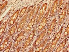 SLC16A9 Antibody - Immunohistochemistry of paraffin-embedded human small intestine tissue using SLC16A9 Antibody at dilution of 1:100